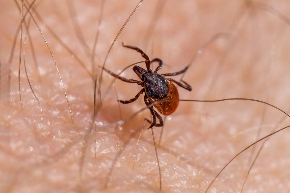 Borrelia Miyamotoi: Die schwierige Diagnose einer seltenen Zeckenkrankheit